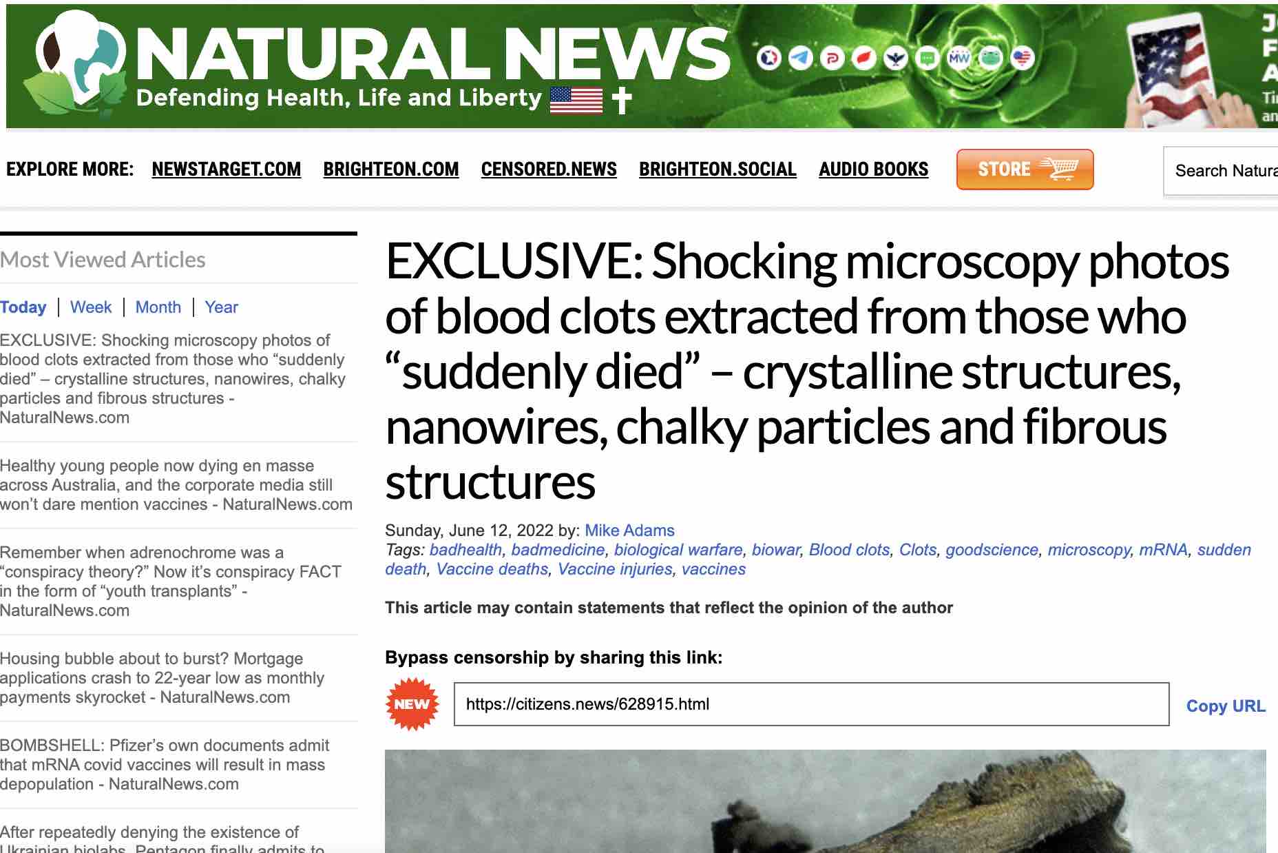photos-microscopiques-dans-natural-news.jpg