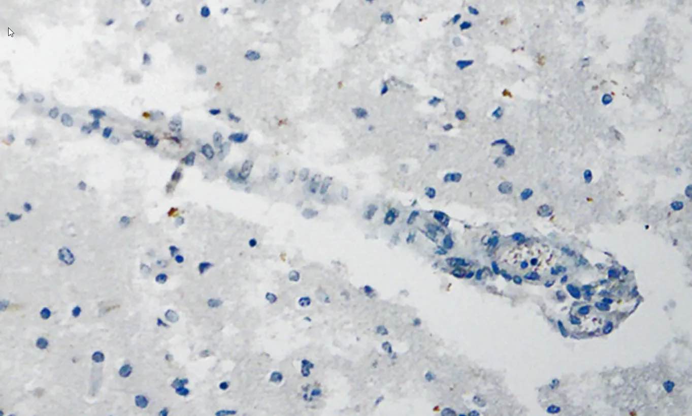 Figure 12. Cerveau, Nucleus ruber. Réaction immunohistochimique négative pour la protéine de nucléocapside du SRAS-CoV-2. Coupe transversale d'un vaisseau capillaire. Grossissement : 200×. Source: MDPI-Vaccin — https://www.mdpi.com/2076-393X/10/10/1651