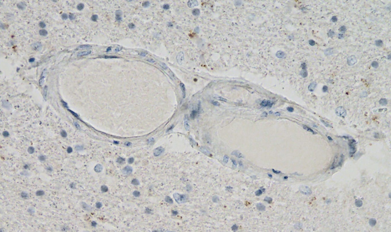 Figure 11. Cerveau frontal. Réaction immunohistochimique négative pour la protéine de nucléocapside du SRAS-CoV-2. Coupe transversale à travers un vaisseau capillaire (même vaisseau que celui illustré à la figure 9, coupes en série de 5 à 20 μm). Grossissement : 200×. Source: MDPI-Vaccines — https://www.mdpi.com/2076-393X/10/10/1651