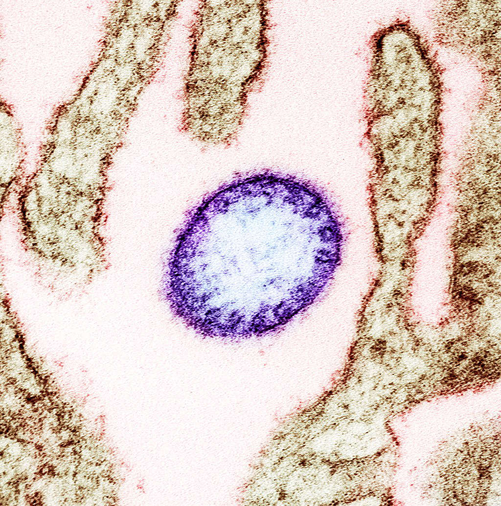 Micrographie électronique en transmission colorisée d'une particule mature du virus Nipah extracellulaire (violet) près de la périphérie d'une cellule VERO infectée (brune). Image capturée et améliorée en couleur au Centre de recherche intégré du NIAID à Fort Detrick, Maryland. Crédit: NIAID