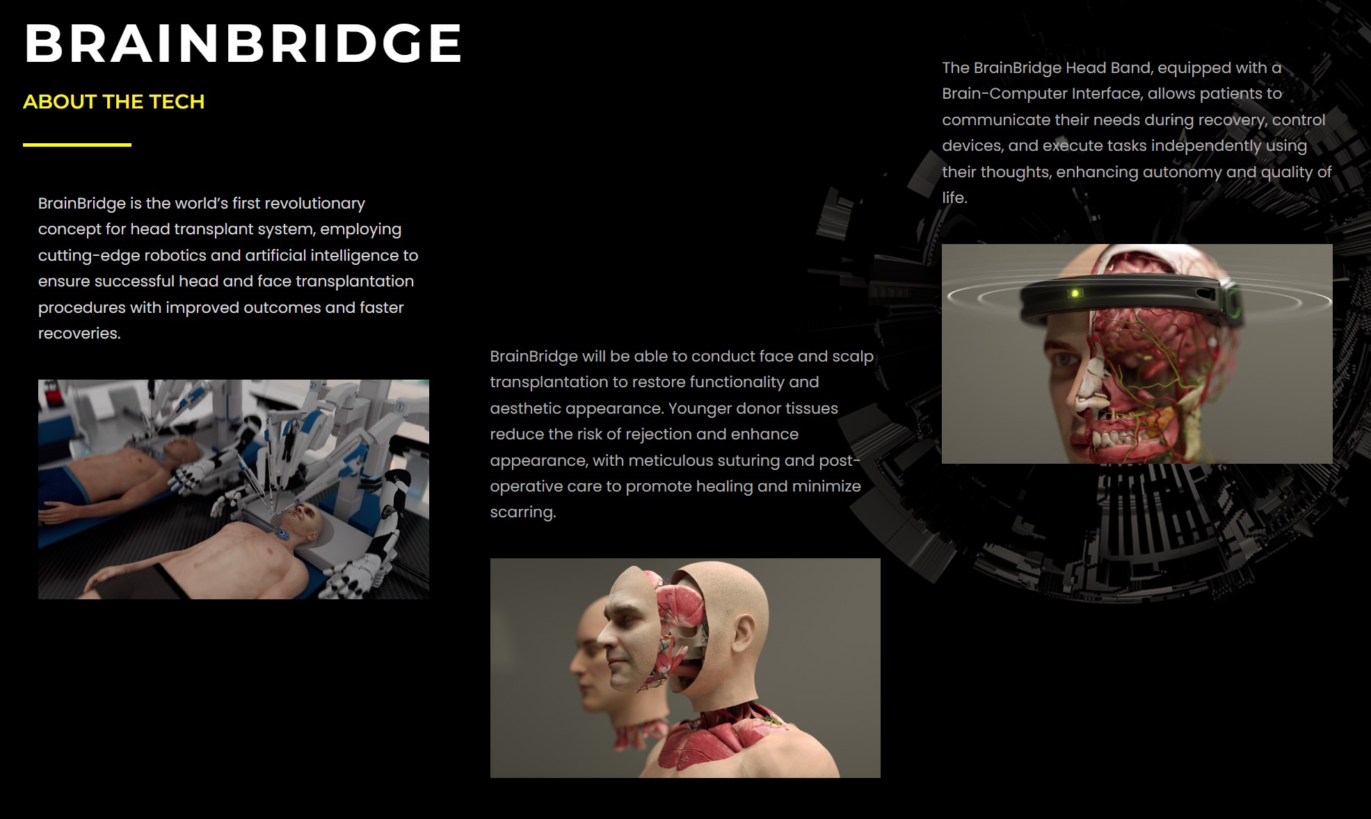 technologie-de-brainbridge.jpg