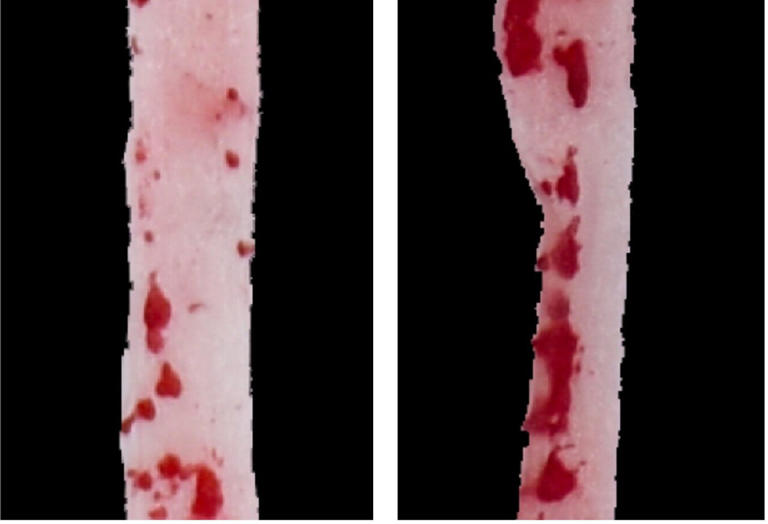 Source: https://www.msn.com/en-us/health/other/artificial-sweetener-triggers-insulin-spike-leading-to-blood-vessel-inflammation-in-mice/ar-AA1znatx