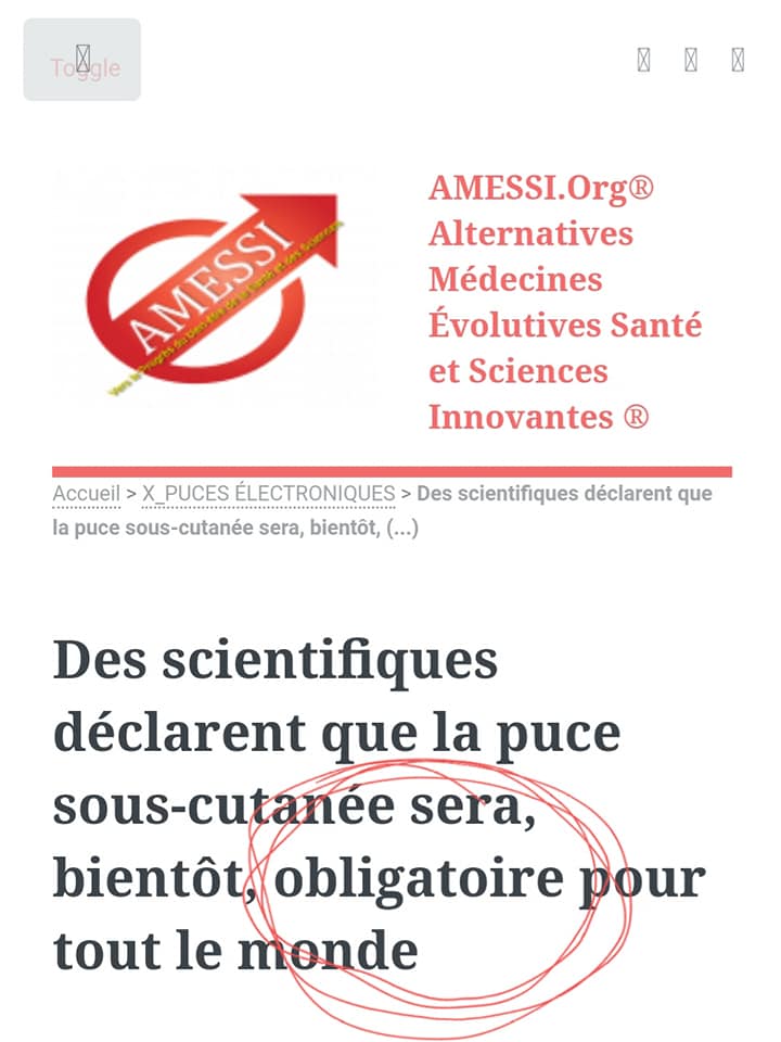 puce-sous-cutanee-bientot-obligatoire.jpg