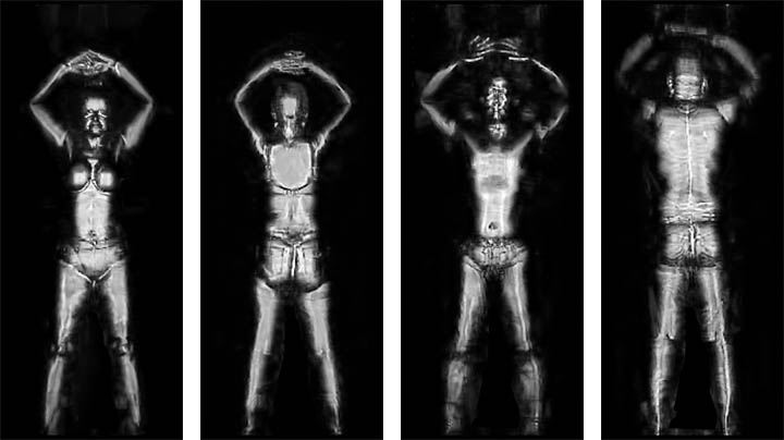 image_prise_par_un_scanneur_corporel_2010.jpg